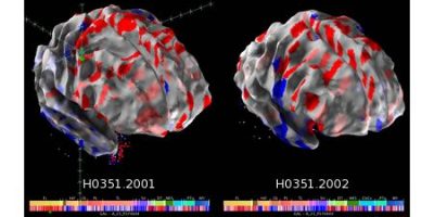 Científicos revelan el primer mapa computarizado del cerebro humano