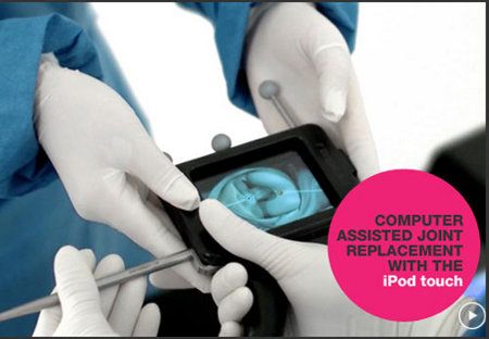 El iPod Touch es utilizado por cirujanos para realizar una cirugía de rodilla