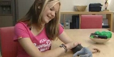 Esta chica de 15 años ya cuenta con su prótesis biónica